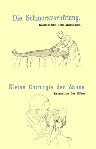 Zähne ziehen narkose - zähne,