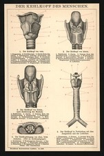 Druck anno 1896 - Kehlkopf