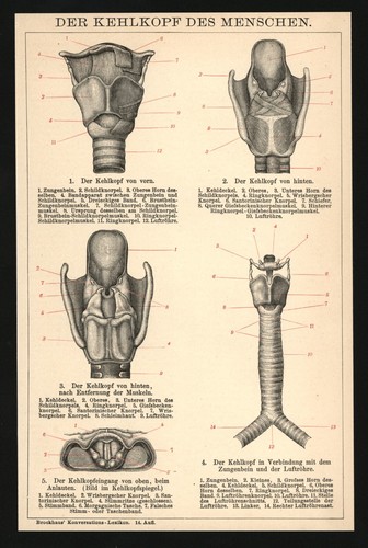 Druck anno 1896 - , kehlkopf