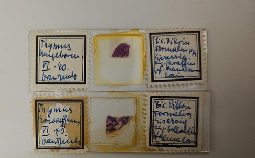 Thymus kind erwachsen - kind,