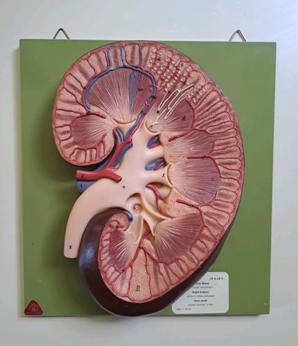 Somso anatomie modell niere - modell,